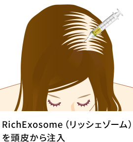 RichExosome（リッシェゾーム）